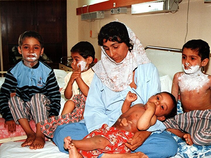 PHOTO: Victims of Chemical Weapons